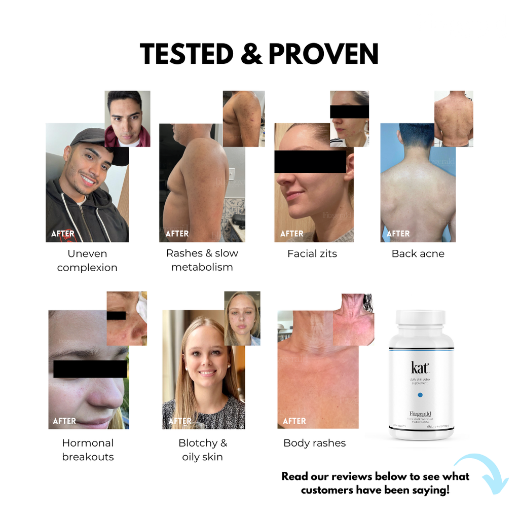 KAT Daily Skin + Liver Detox